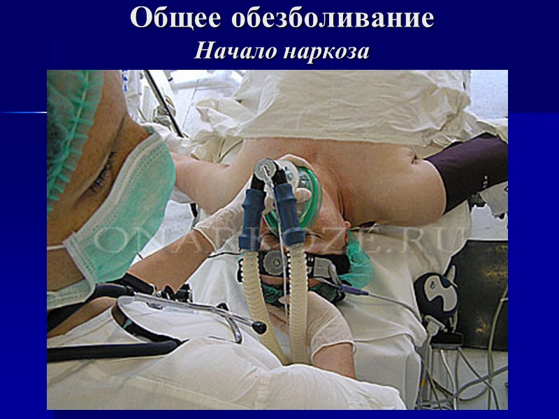 Общее обезболивание Начало наркоза